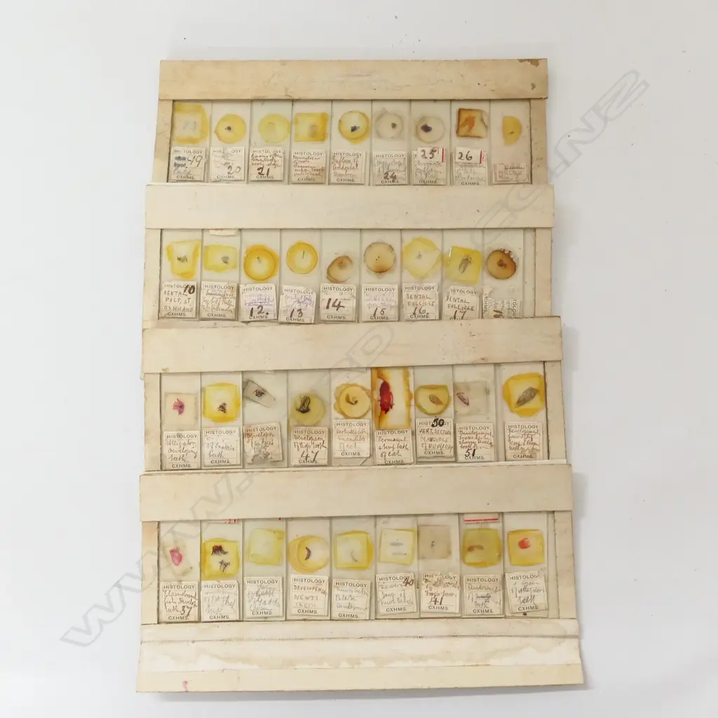 BOX OF VINTAGE MICROSCOPIC DENTAL (HISTOLOGY) SLIDES & ANOTHER SMALL BOX OF SLIDES Image 1++